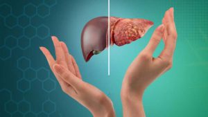 Physicians should be raised their knowledge about non-alcoholic fatty liver disease (NAFLD)